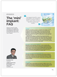 The 'mini' implant: FAQ