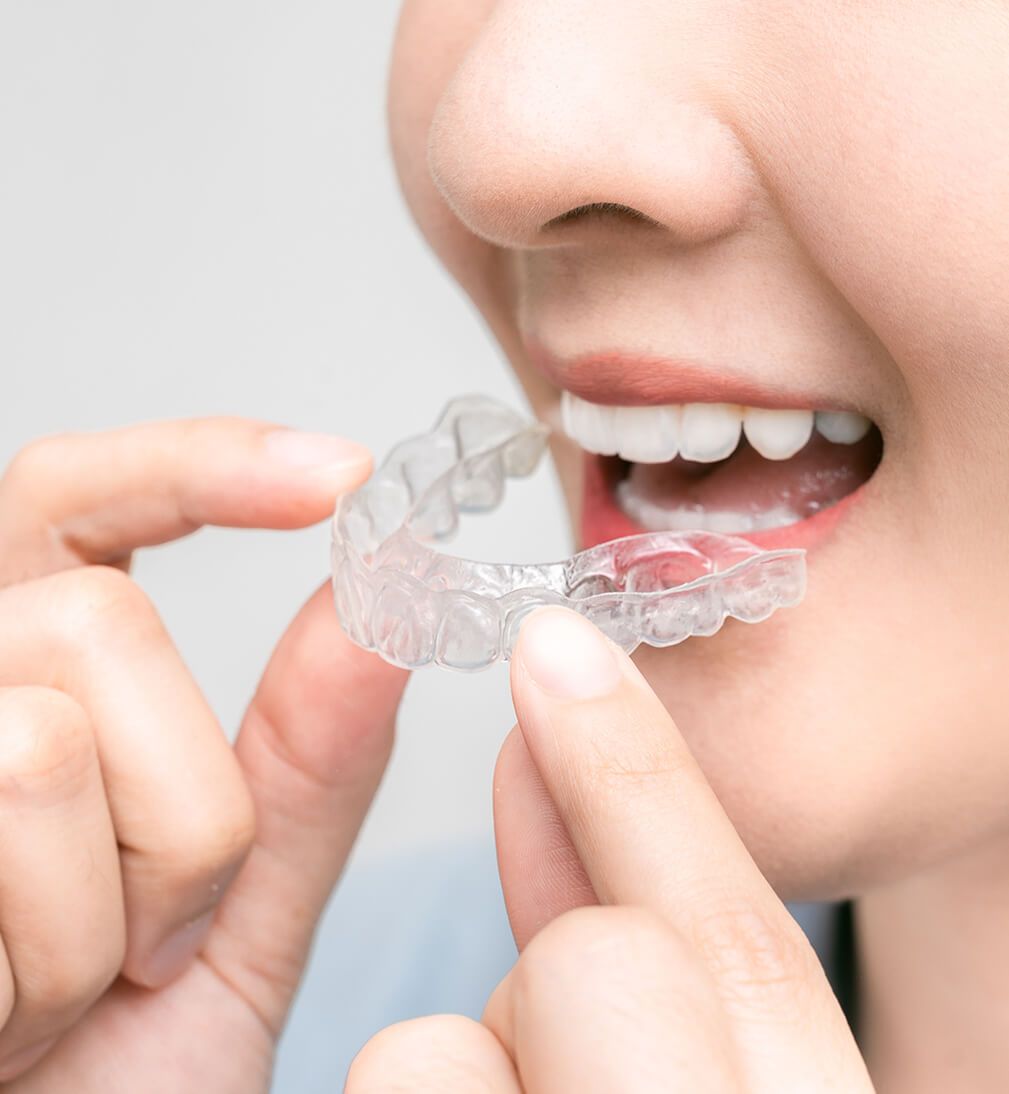 Girl with Aligners