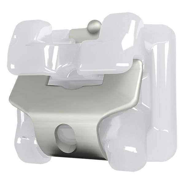 Ceramic Braces