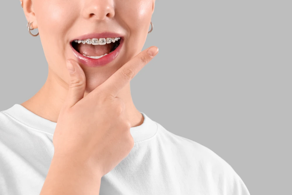 Person smiling with braces
