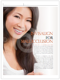 Invisalign for Malocclusion